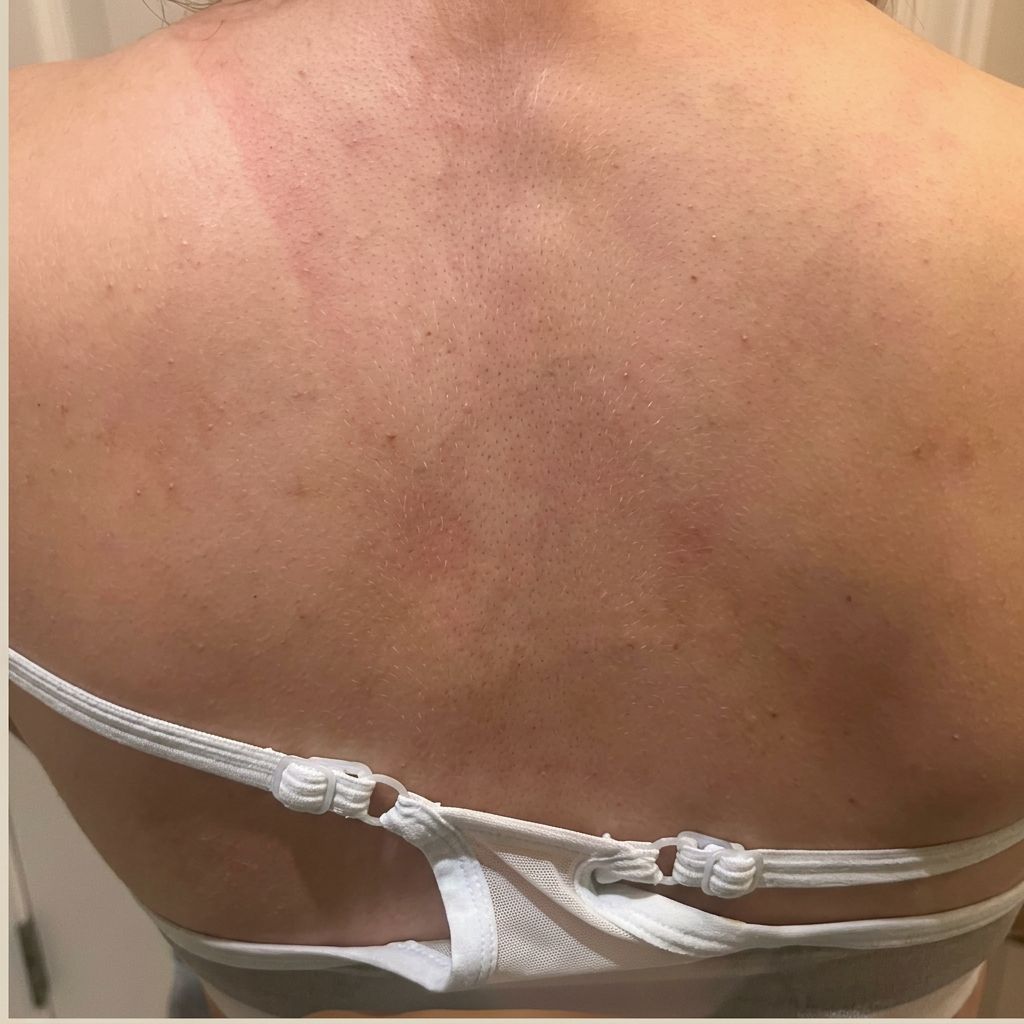 Skin & body before and after switching to filtered shower water — after
